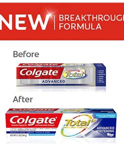 Colgate Total Advanced Whitening Toothpaste, 3.4 Ounce - Suthern Picker