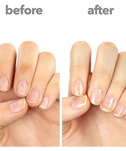 ella+mila First Aid Kiss Nail Strengthener & Growth Treatment With Vitamin E - Suthern Picker