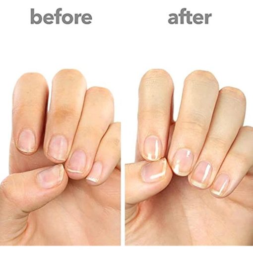 ella+mila First Aid Kiss Nail Strengthener & Growth Treatment With Vitamin E - Suthern Picker
